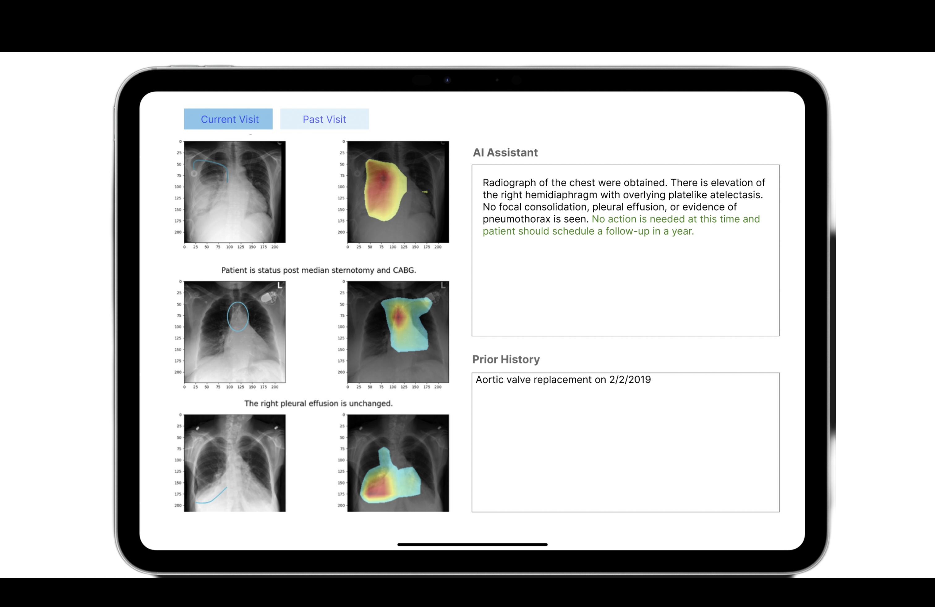 AI MedXpert Demo